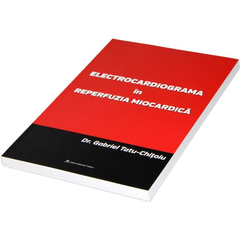 Electrocardiograma în reperfuzia miocardică