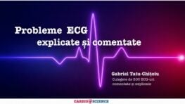 Probleme de electrocardiografie - 300 de ECG-uri comentate și explicate (varianta PDF, accesare din platformă)